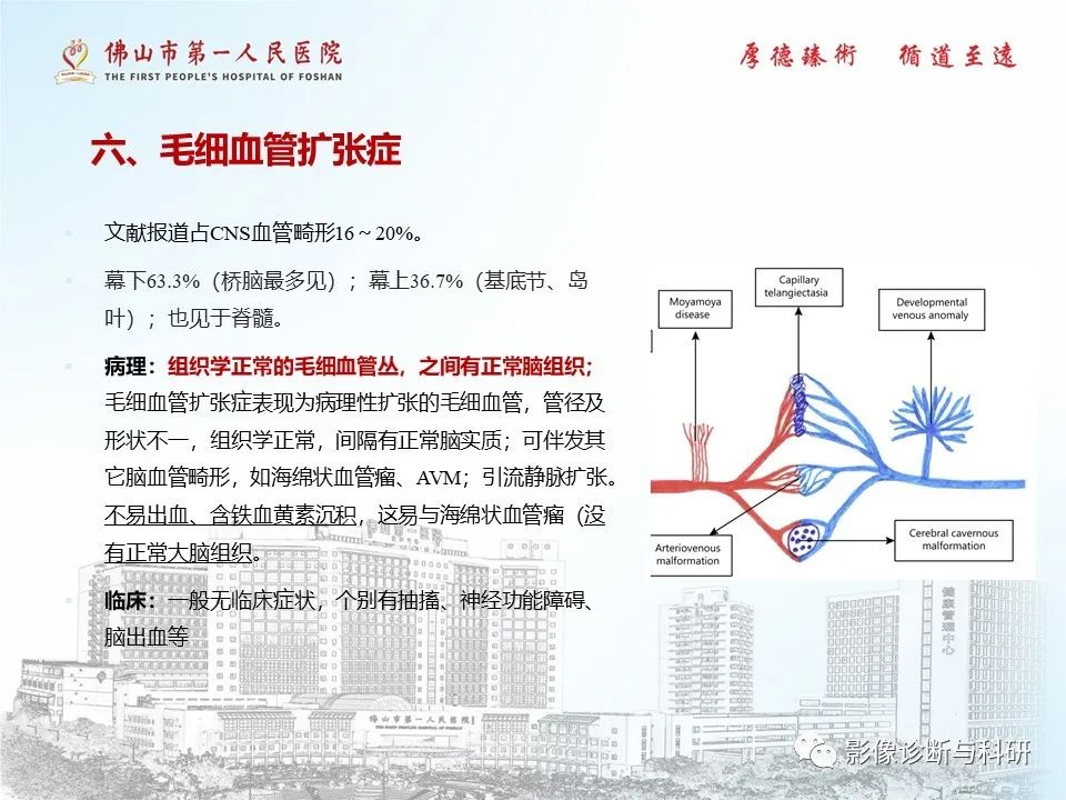 影像PPT - 【PPT】脑血管畸形的影像诊断-37