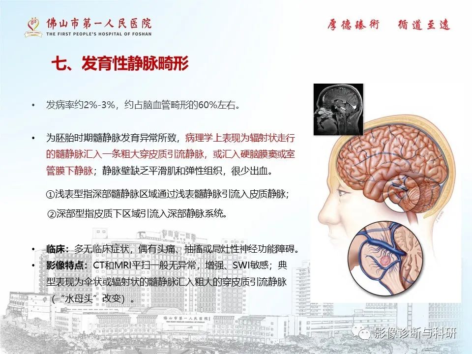 影像PPT - 【PPT】脑血管畸形的影像诊断-42