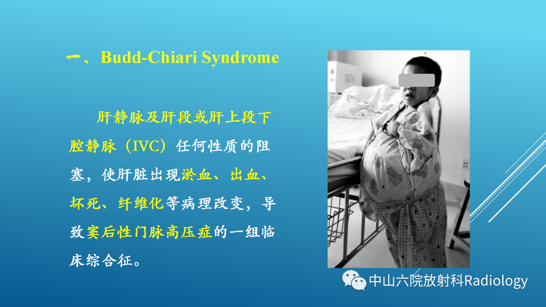 影像PPT - 【PPT】Budd-Chiari Syndrome综合征的影像学表现-3