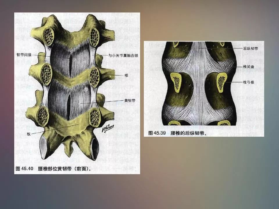 影像PPT - 【PPT】腰椎退行性变腰痛的MR诊断-4