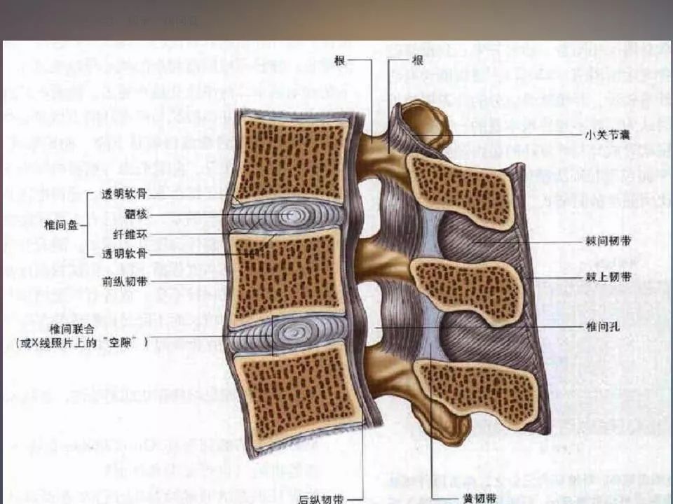 影像PPT - 【PPT】腰椎退行性变腰痛的MR诊断-3