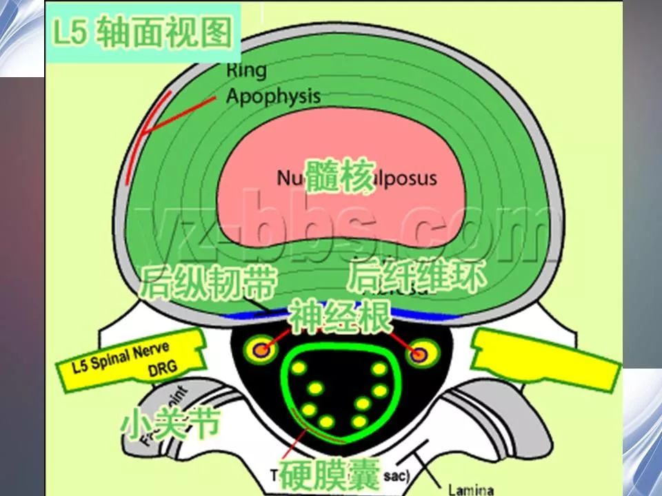 影像PPT - 【PPT】腰椎退行性变腰痛的MR诊断-5