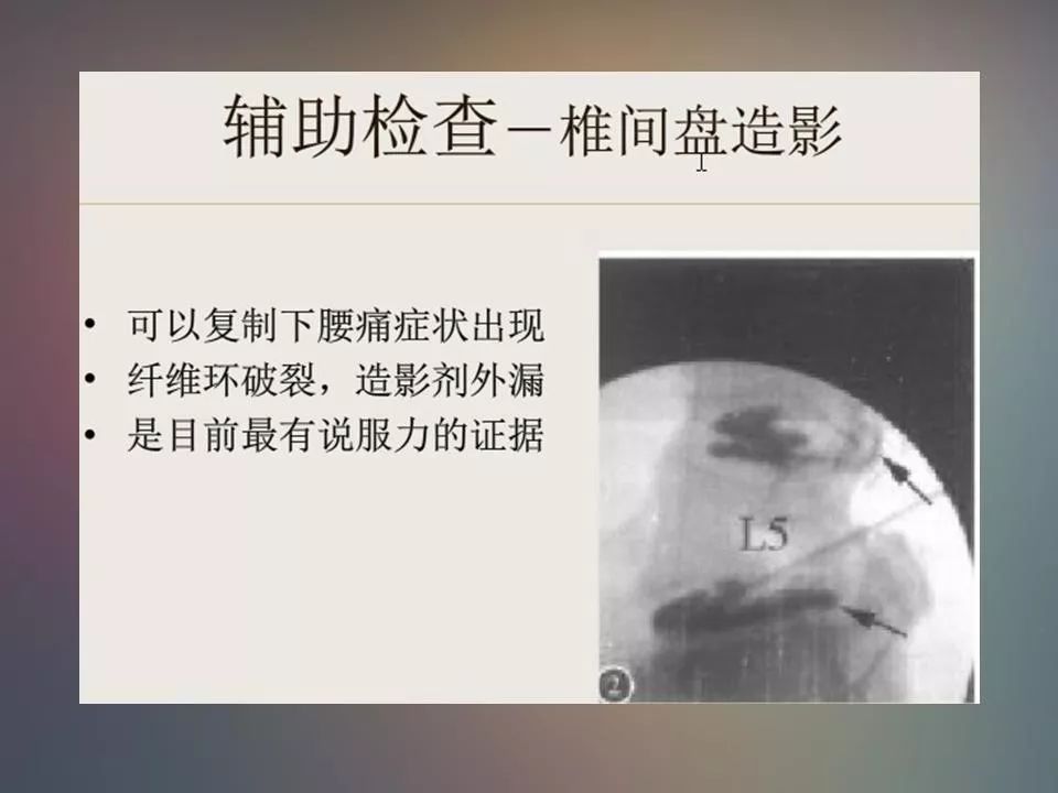 影像PPT - 【PPT】腰椎退行性变腰痛的MR诊断-14