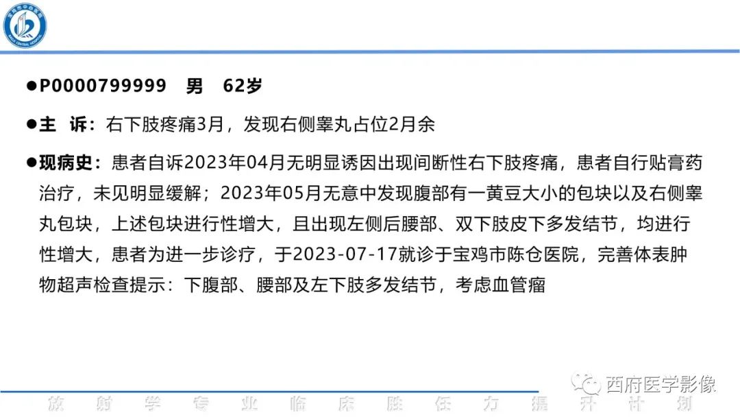 影像PPT - 【病例】睾丸浆细胞骨髓瘤1例CT及MR影像-2