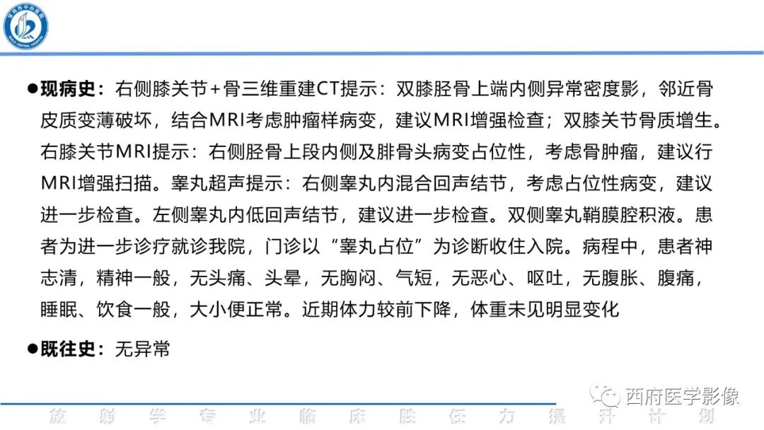 影像PPT - 【病例】睾丸浆细胞骨髓瘤1例CT及MR影像-3