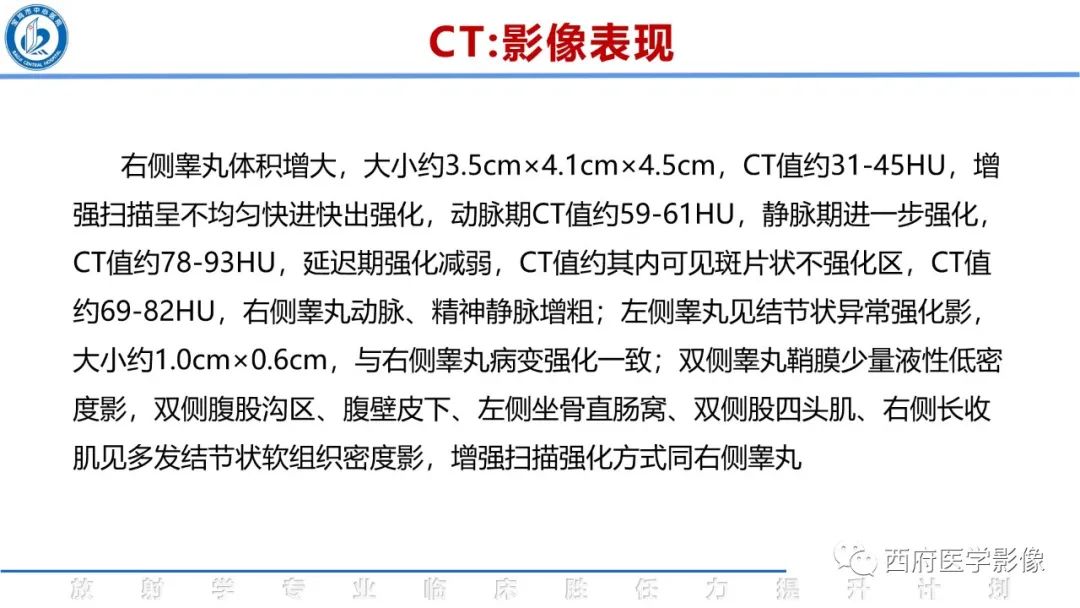 影像PPT - 【病例】睾丸浆细胞骨髓瘤1例CT及MR影像-11