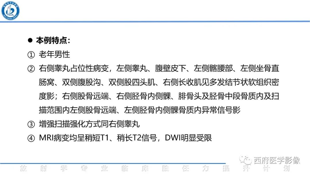 影像PPT - 【病例】睾丸浆细胞骨髓瘤1例CT及MR影像-19