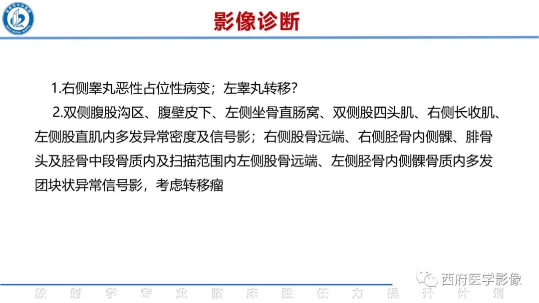 影像PPT - 【病例】睾丸浆细胞骨髓瘤1例CT及MR影像-21