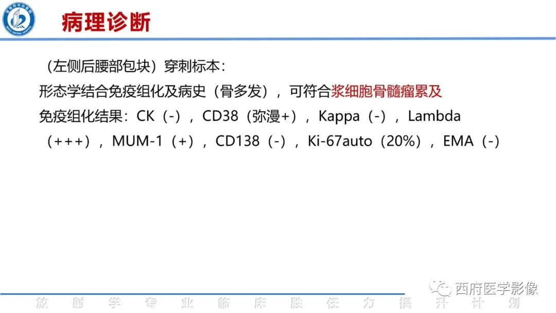 影像PPT - 【病例】睾丸浆细胞骨髓瘤1例CT及MR影像-24