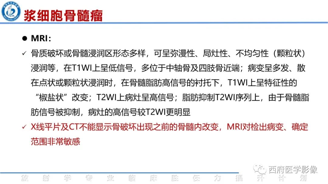 影像PPT - 【病例】睾丸浆细胞骨髓瘤1例CT及MR影像-40
