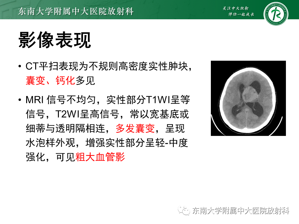 影像PPT - 【PPT】侧脑室脑膜瘤-32