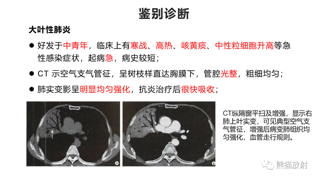 影像PPT - 【病例】肺炎型肺癌 VS 肺组织慢性炎-28