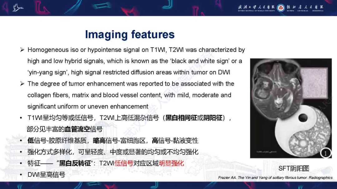 影像PPT - 【PPT】脑室孤立性纤维性肿瘤影像诊断-12
