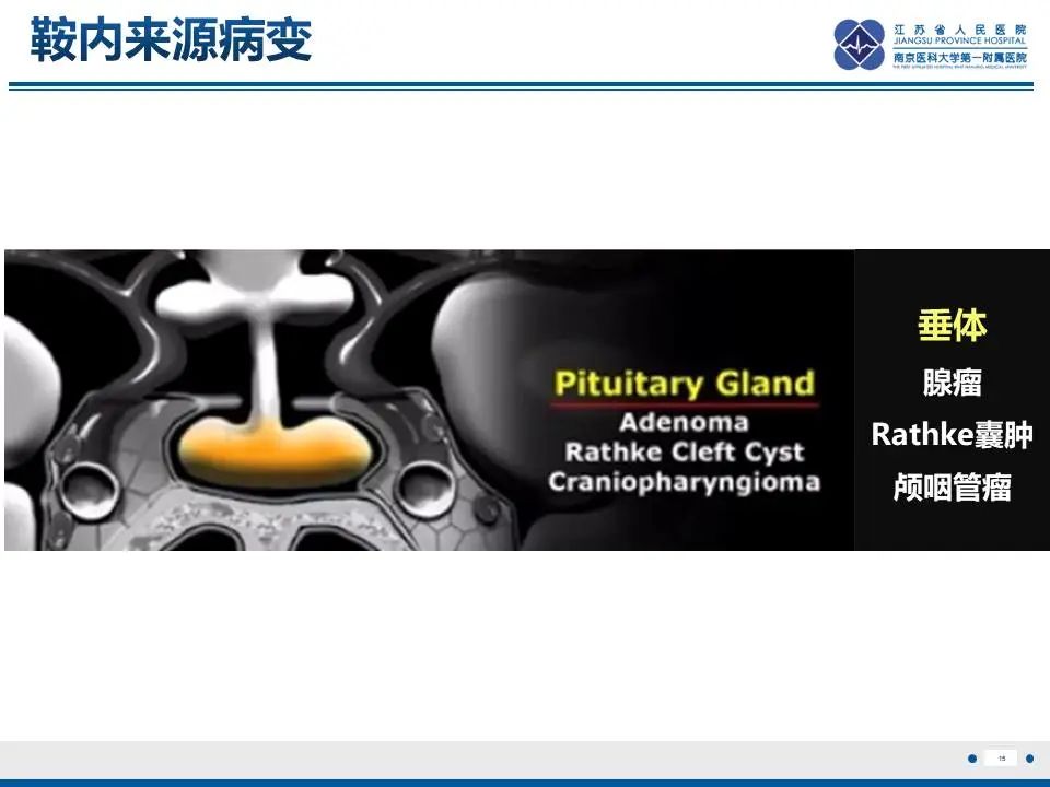 影像PPT - 【PPT】神经垂体颗粒细胞瘤-16
