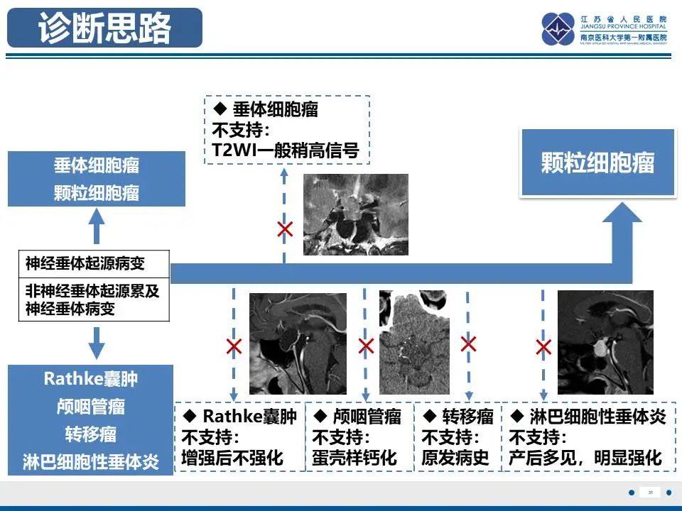 影像PPT - 【PPT】神经垂体颗粒细胞瘤-32