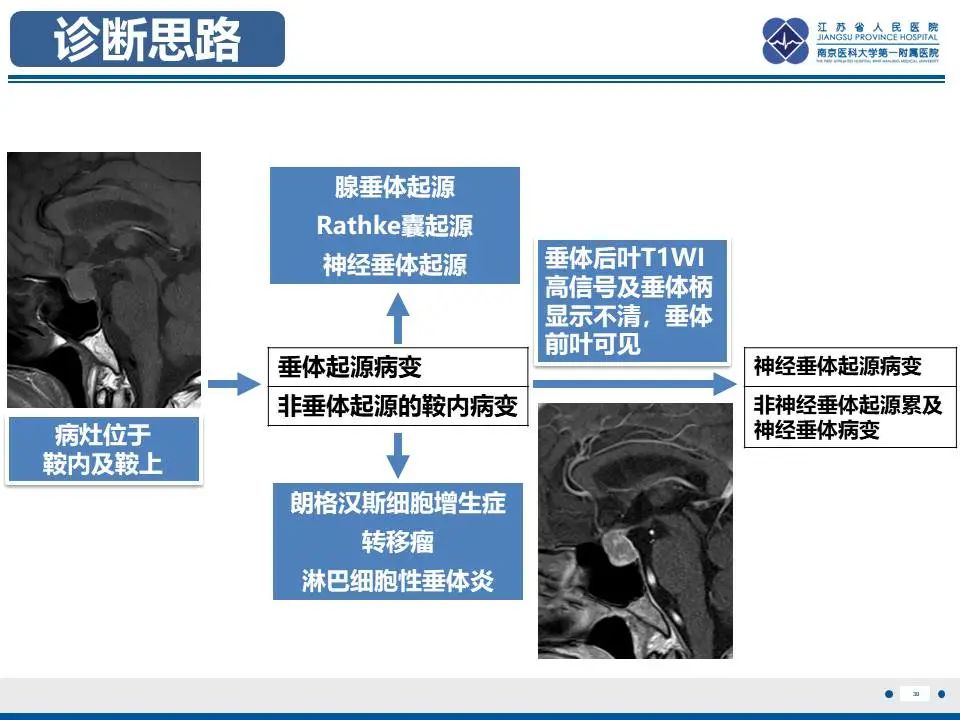 影像PPT - 【PPT】神经垂体颗粒细胞瘤-31