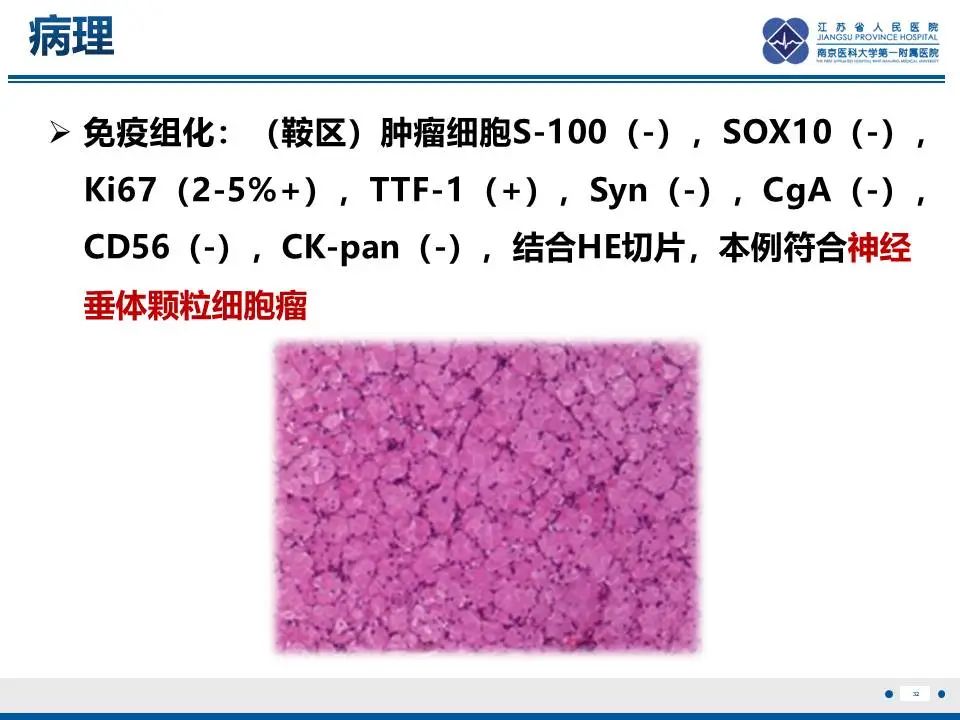 影像PPT - 【PPT】神经垂体颗粒细胞瘤-33