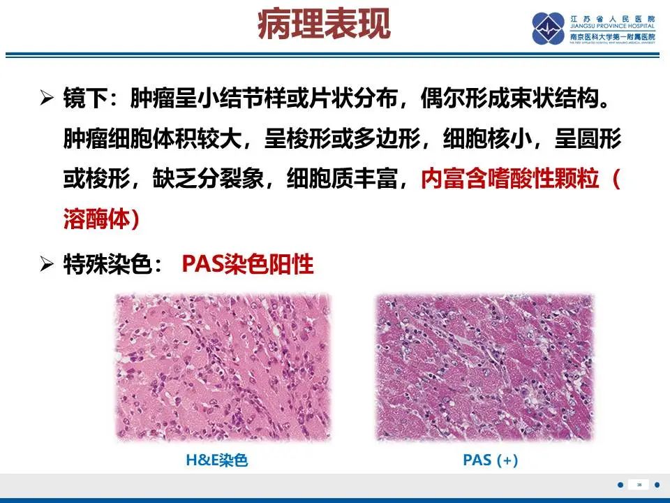 影像PPT - 【PPT】神经垂体颗粒细胞瘤-37