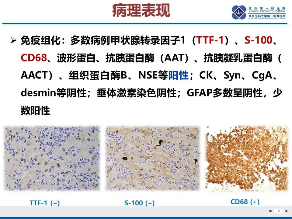 影像PPT - 【PPT】神经垂体颗粒细胞瘤-38