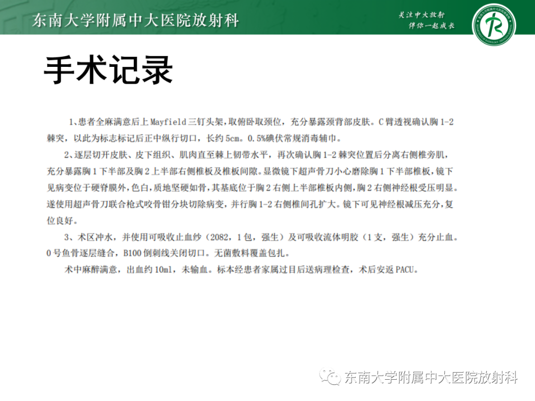 影像PPT - 【PPT】脊柱骨软骨瘤-3