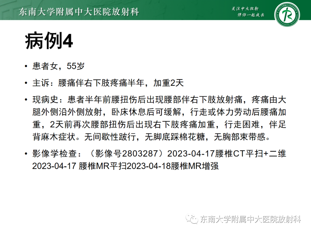 影像PPT - 【PPT】脊柱骨软骨瘤-30