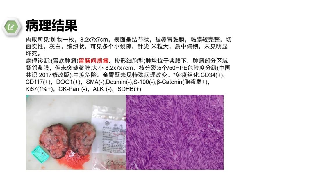 影像PPT - 【病例】胃底间质瘤1例CT影像-10