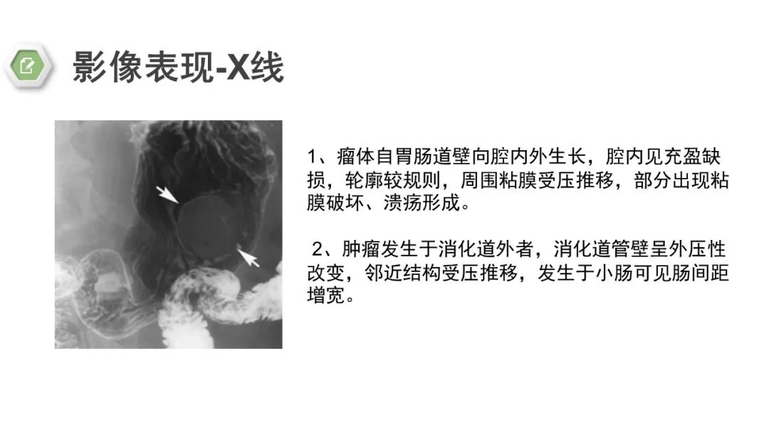 影像PPT - 【病例】胃底间质瘤1例CT影像-14