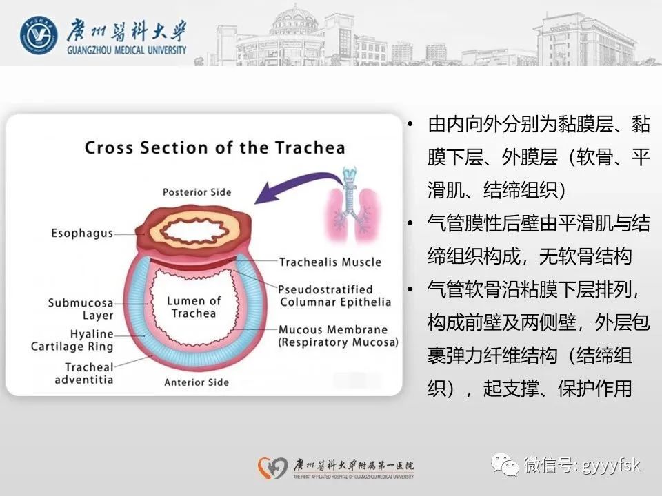 影像PPT - 【病例】支气管淀粉样变1例CT影像-22