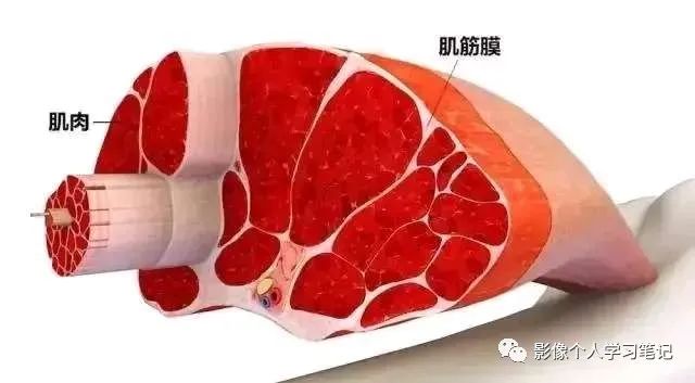 影像PPT - 腰椎MRI容易忽视的腰背部皮下筋膜炎-5 影像PPT - 腰椎MRI容易忽视的腰背部皮下筋膜炎-5