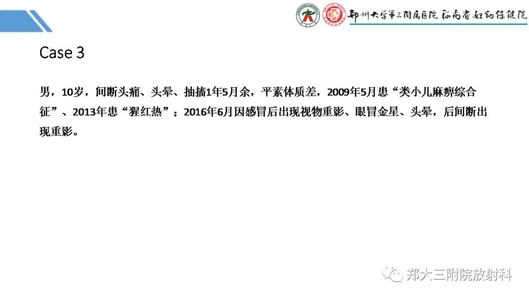 影像PPT - 【PPT】Melas综合征的影像诊断-21