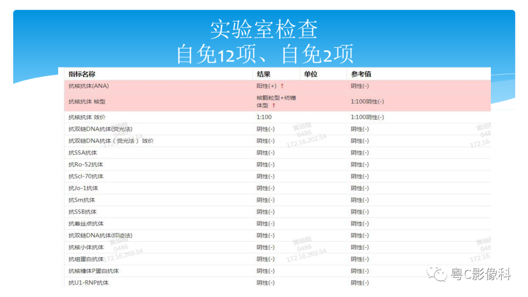 影像PPT - 【PPT】亨特综合征-5 影像PPT - 【PPT】亨特综合征-5