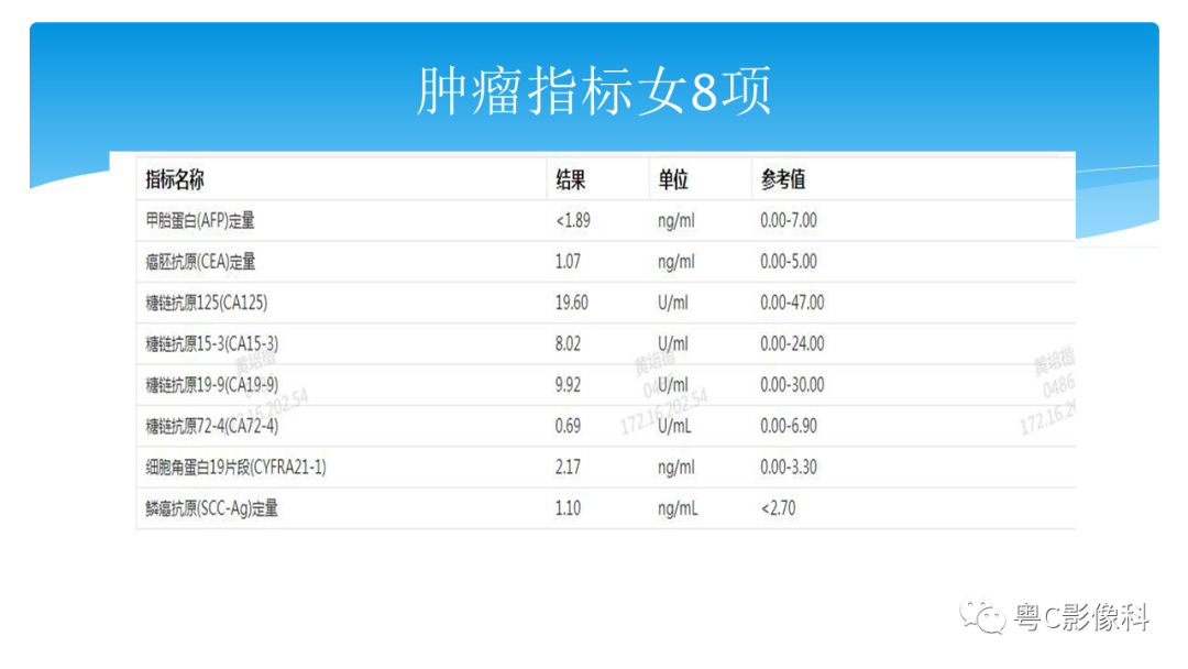 影像PPT - 【PPT】亨特综合征-6 影像PPT - 【PPT】亨特综合征-6