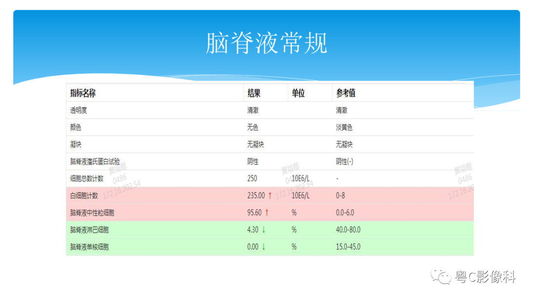 影像PPT - 【PPT】亨特综合征-7 影像PPT - 【PPT】亨特综合征-7