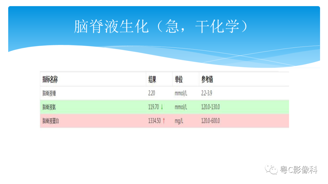 影像PPT - 【PPT】亨特综合征-8 影像PPT - 【PPT】亨特综合征-8