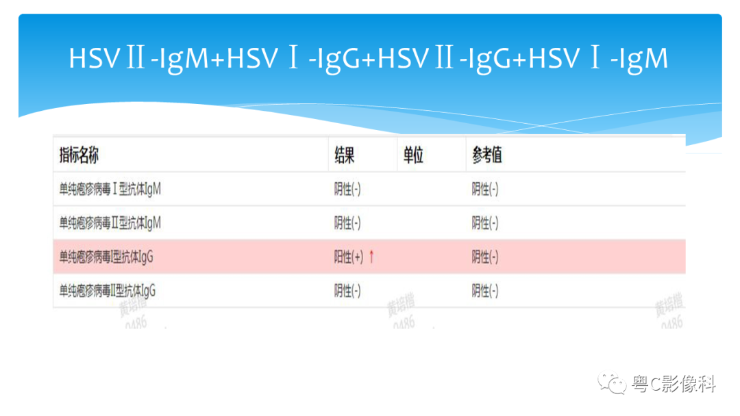 影像PPT - 【PPT】亨特综合征-9 影像PPT - 【PPT】亨特综合征-9