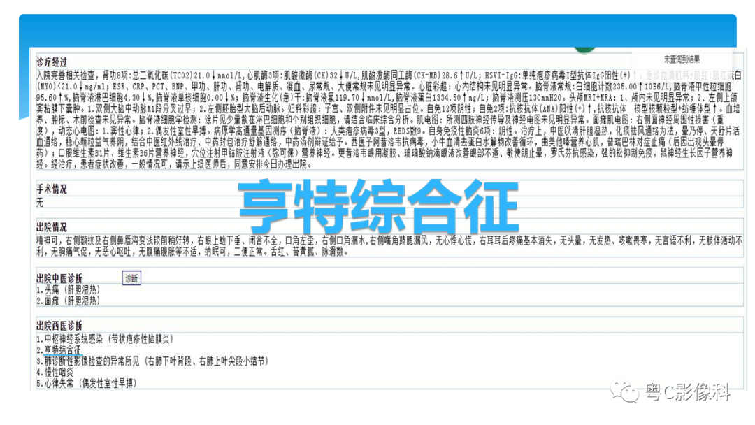 影像PPT - 【PPT】亨特综合征-18 影像PPT - 【PPT】亨特综合征-18