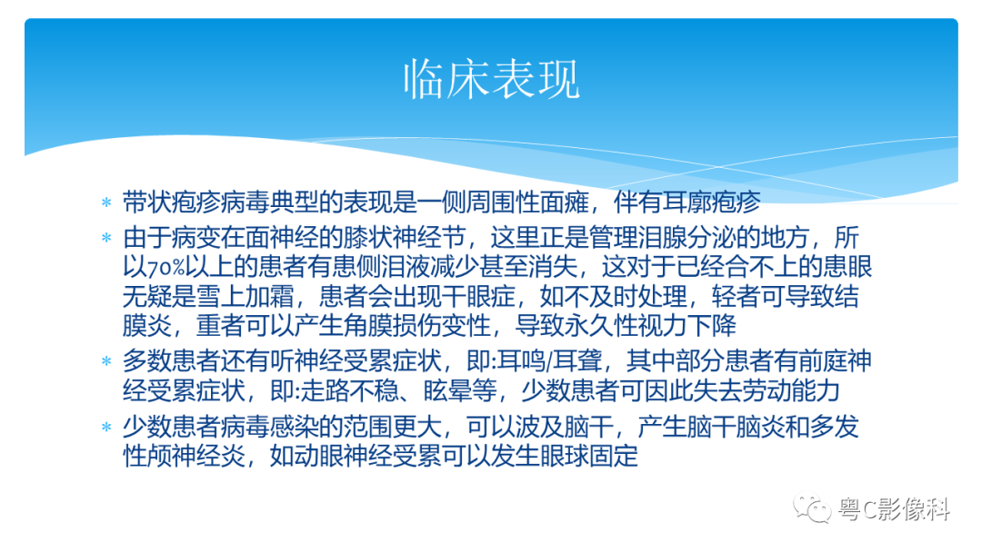 影像PPT - 【PPT】亨特综合征-22 影像PPT - 【PPT】亨特综合征-22