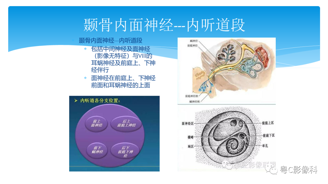 影像PPT - 【PPT】亨特综合征-36 影像PPT - 【PPT】亨特综合征-36