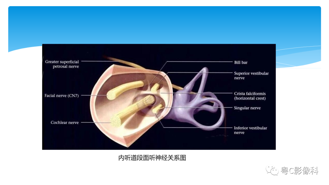 影像PPT - 【PPT】亨特综合征-38 影像PPT - 【PPT】亨特综合征-38