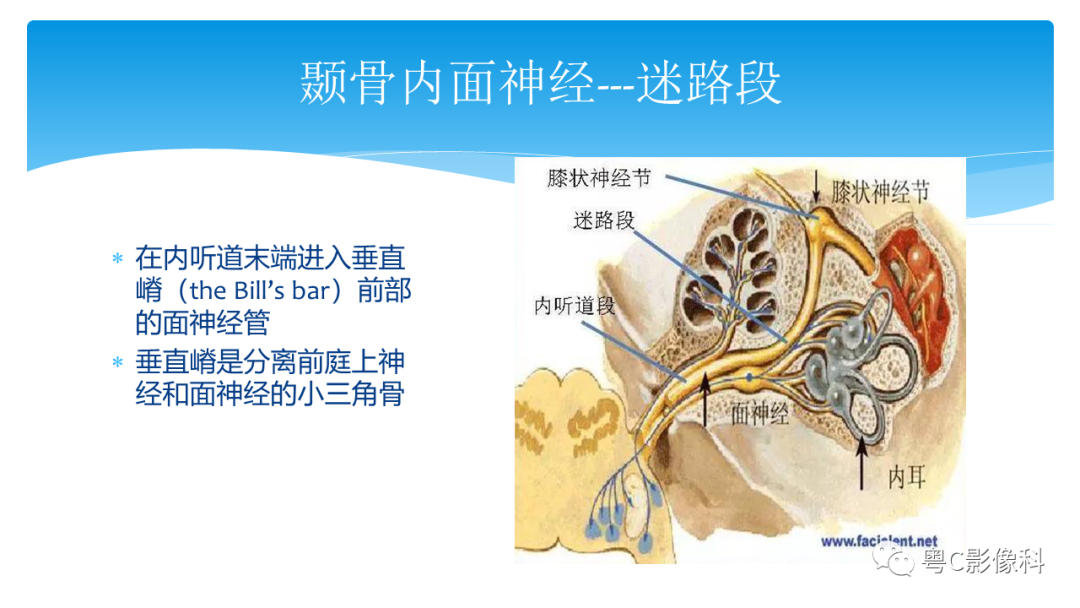 影像PPT - 【PPT】亨特综合征-39 影像PPT - 【PPT】亨特综合征-39