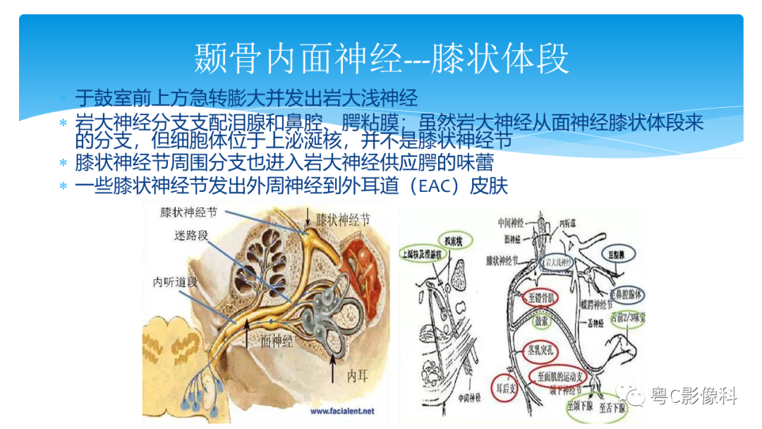 影像PPT - 【PPT】亨特综合征-42 影像PPT - 【PPT】亨特综合征-42