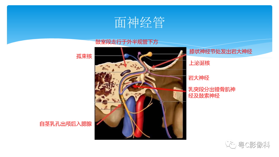 影像PPT - 【PPT】亨特综合征-45 影像PPT - 【PPT】亨特综合征-45