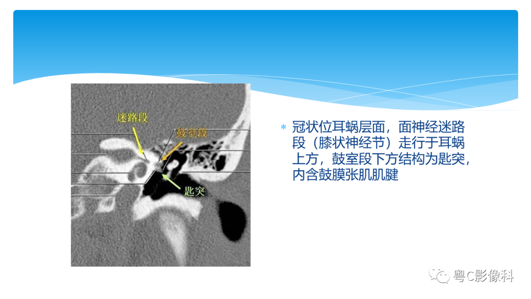 影像PPT - 【PPT】亨特综合征-49 影像PPT - 【PPT】亨特综合征-49