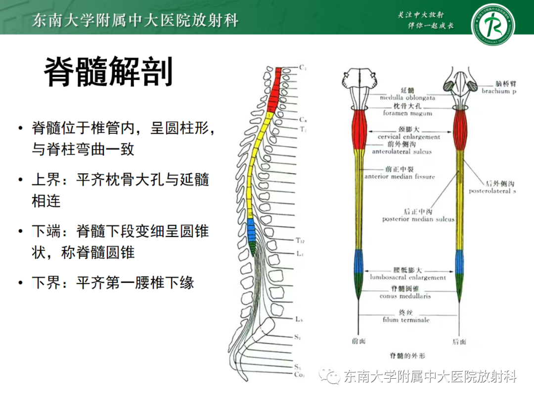 影像PPT - 【PPT】脊髓栓系综合征-9 影像PPT - 【PPT】脊髓栓系综合征-9