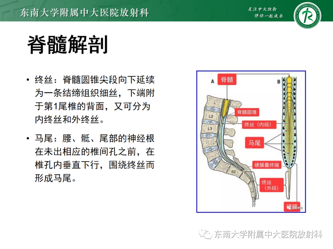影像PPT - 【PPT】脊髓栓系综合征-10 影像PPT - 【PPT】脊髓栓系综合征-10