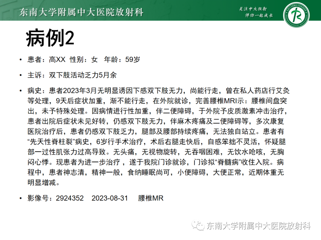 影像PPT - 【PPT】脊髓栓系综合征-22 影像PPT - 【PPT】脊髓栓系综合征-22