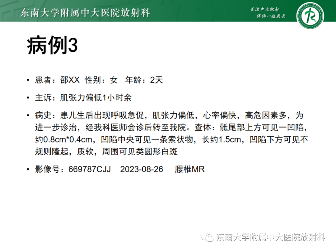 影像PPT - 【PPT】脊髓栓系综合征-27 影像PPT - 【PPT】脊髓栓系综合征-27