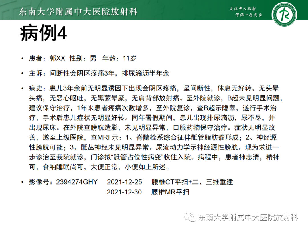 影像PPT - 【PPT】脊髓栓系综合征-31 影像PPT - 【PPT】脊髓栓系综合征-31
