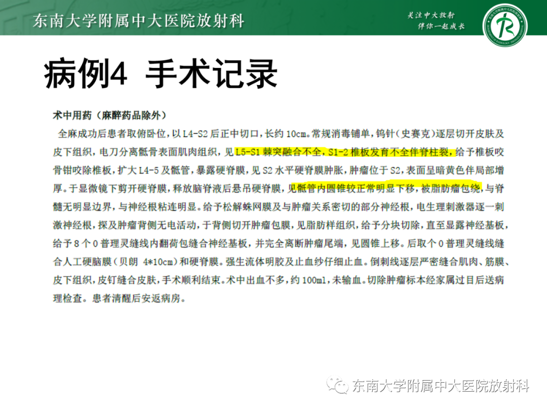 影像PPT - 【PPT】脊髓栓系综合征-33 影像PPT - 【PPT】脊髓栓系综合征-33