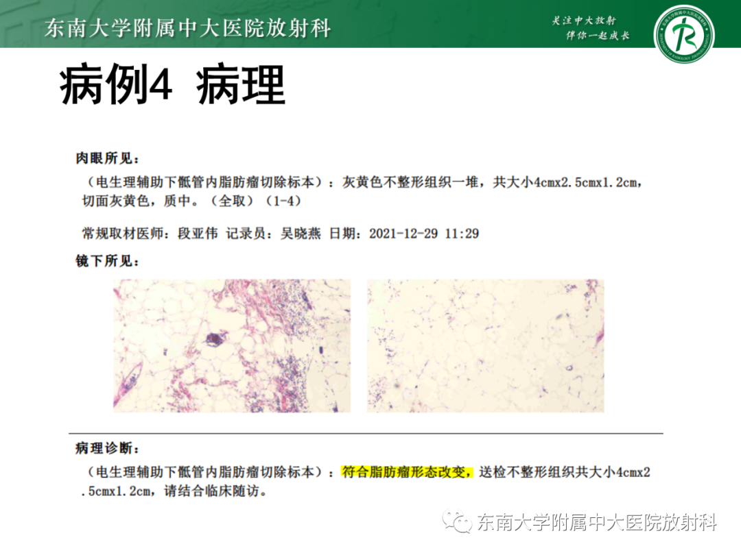 影像PPT - 【PPT】脊髓栓系综合征-34 影像PPT - 【PPT】脊髓栓系综合征-34